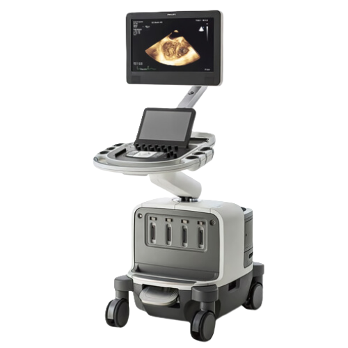 УЗИ аппарат Philips EPIQ Elite