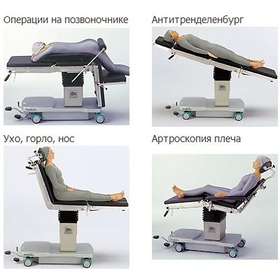 Операционный стол Schmitz OPX mobilis 300