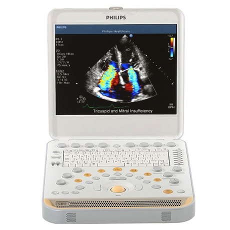 УЗИ система Philips CX50