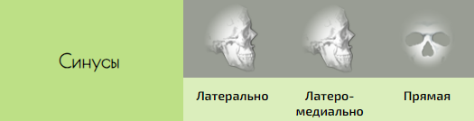 36.PNG