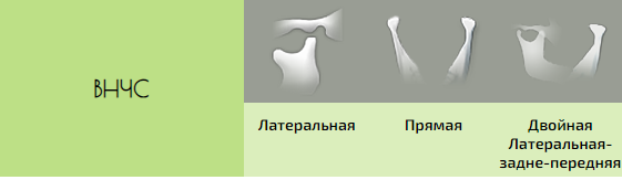 13.PNG