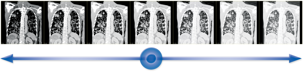 ct-aquilion-lightning-80-benefits-hybridview.png