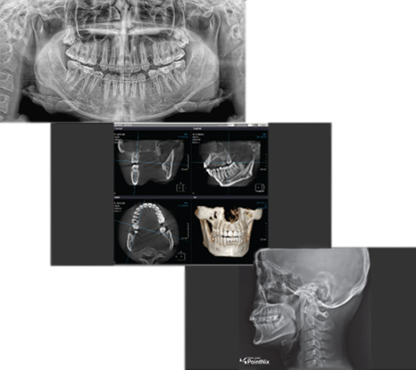 PointNix Point 3D Combi 500