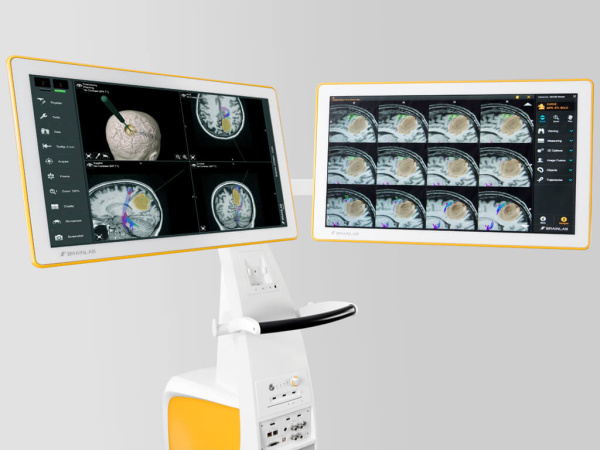 Brainlab Curve