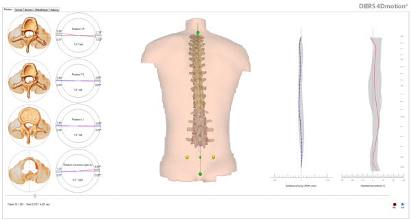 DIERS 4D Motion® (видеозапись, 60 кадров)