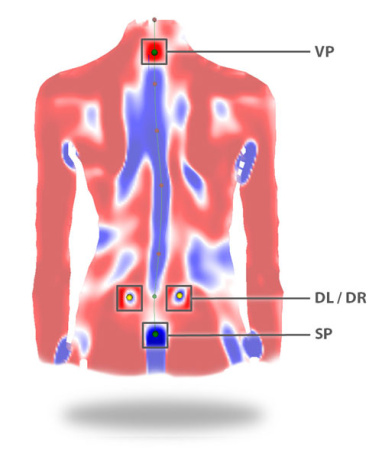 DIERS Formetric 4D (10 кадров)