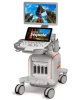Siemens ACUSON Sequoia