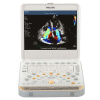 УЗИ система Philips CX50
