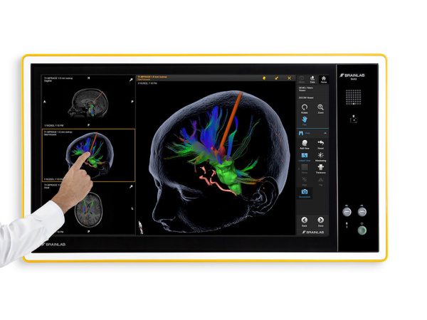 Brainlab BUZZ Digital O.R.