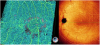 Optovue SOLIX